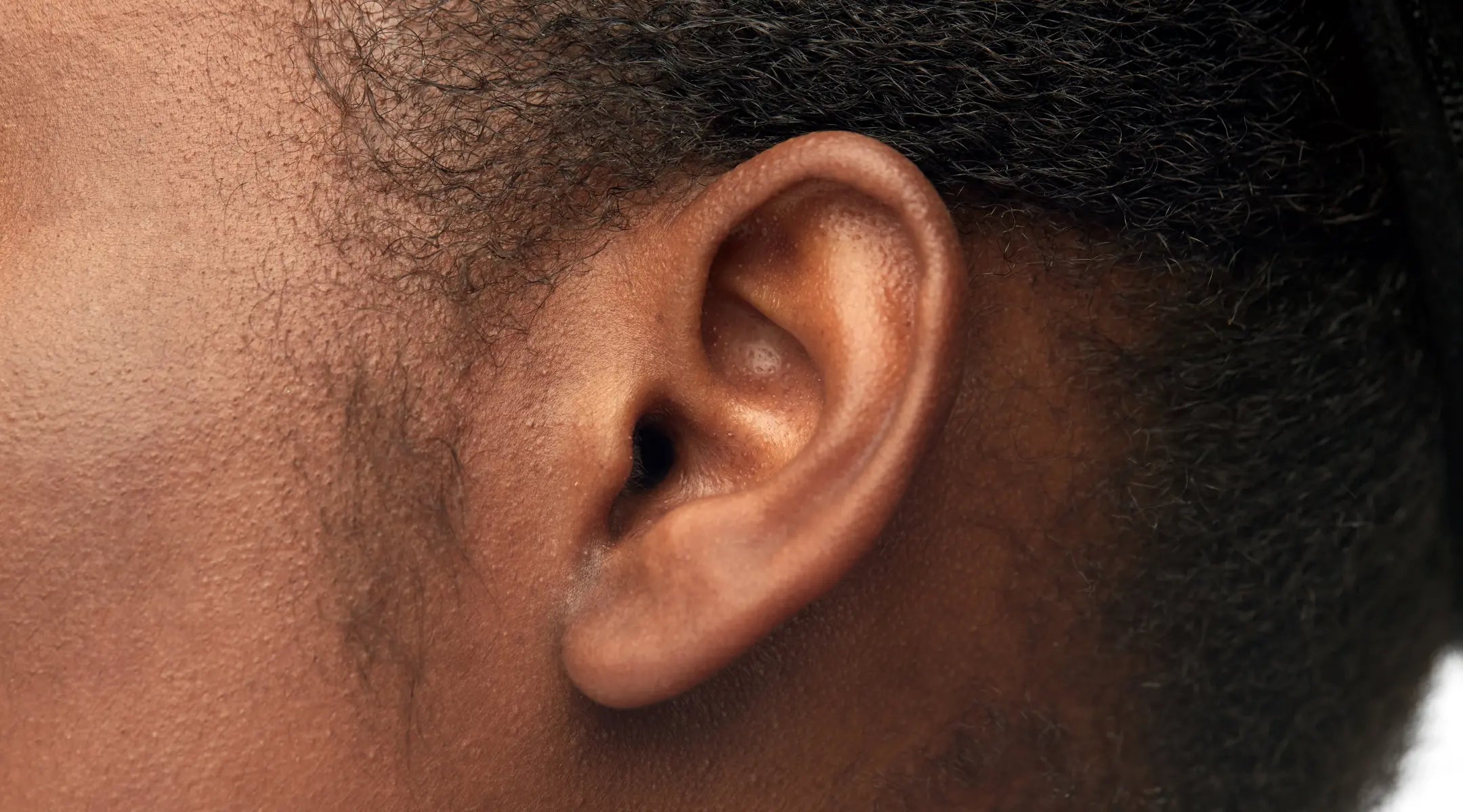 What is Pulsatile Tinnitus?